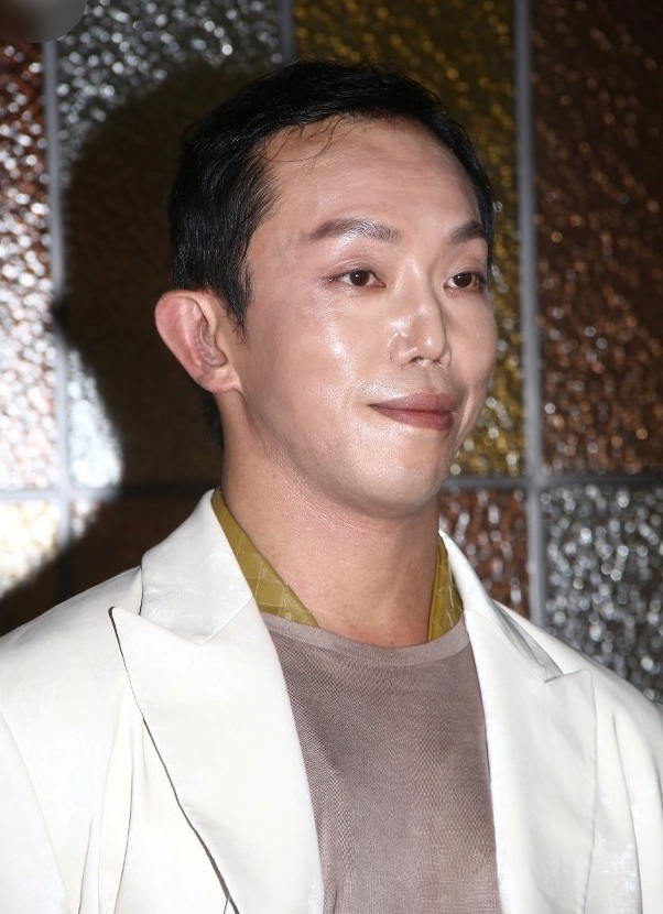 "Hoàng tử showbiz" bị vỡ nát gương mặt, phẫu thuật hơn 10 lần để sửa dung mạo méo mó biến dạng- Ảnh 3.
