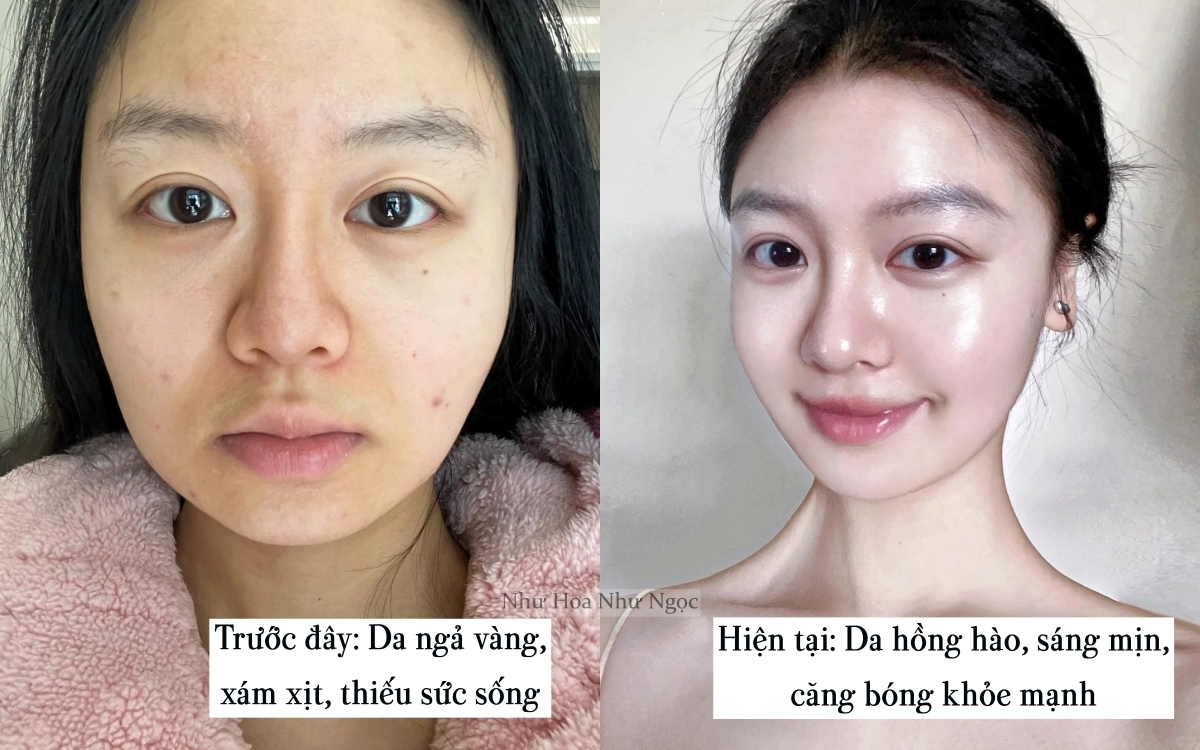 Tuổi 30 có làn da sáng bật tông và căng đầy collagen là nhờ bí kíp "nuôi" da từ gốc- Ảnh 1.