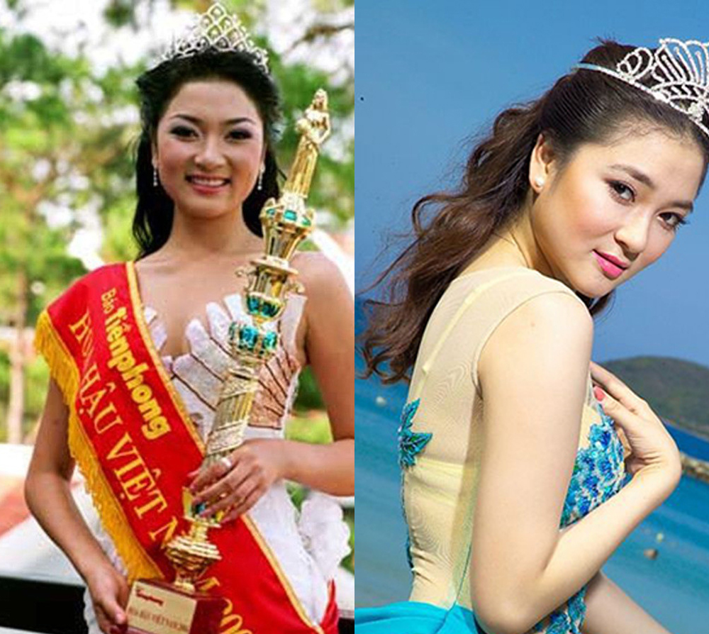 Hoa hậu Việt mắc bệnh lạ: Thường lên cơn co giật, bị bệnh viện trả về, 10 ngón tay đều có sẹo- Ảnh 1.
