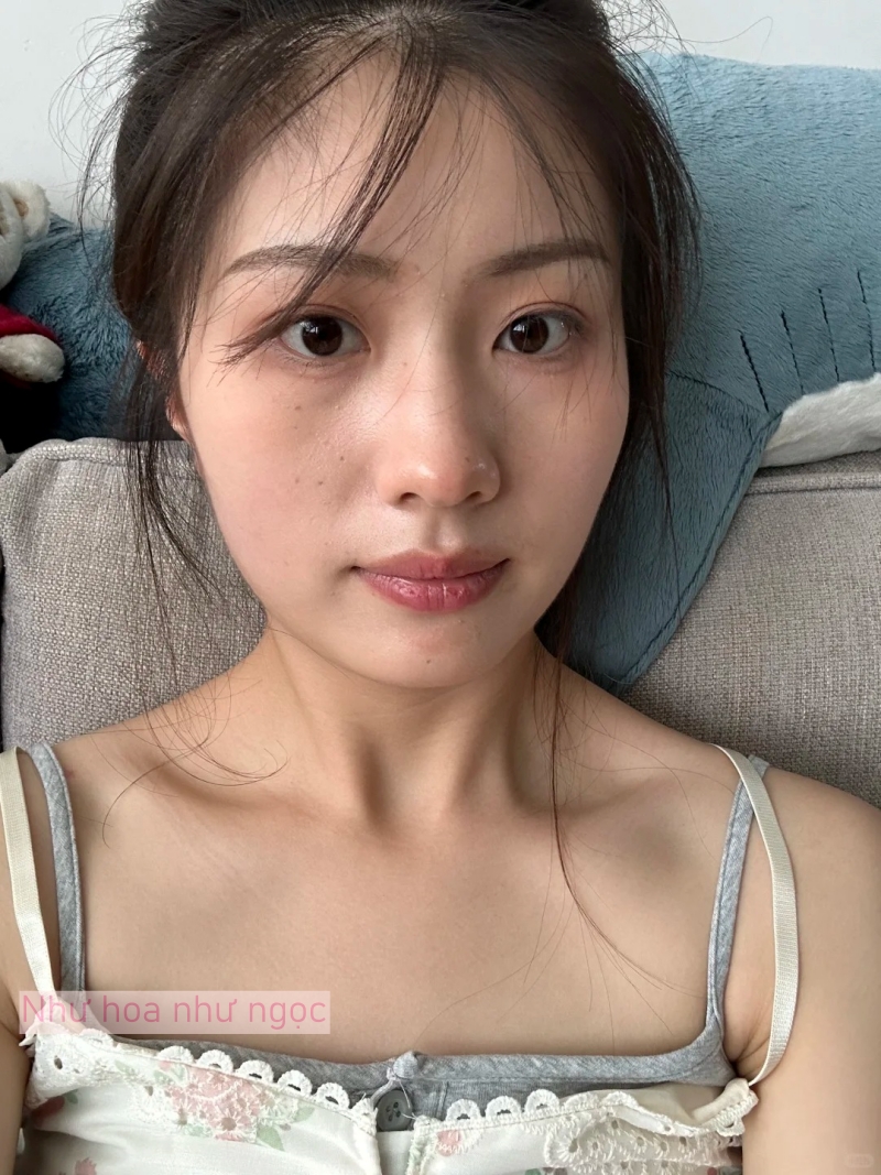 Tôi bất ngờ vì dùng serum collagen kèm cây lăn kim, ban đầu hơi sợ nhưng càng dùng lại thấy da càng đẹp- Ảnh 1.
