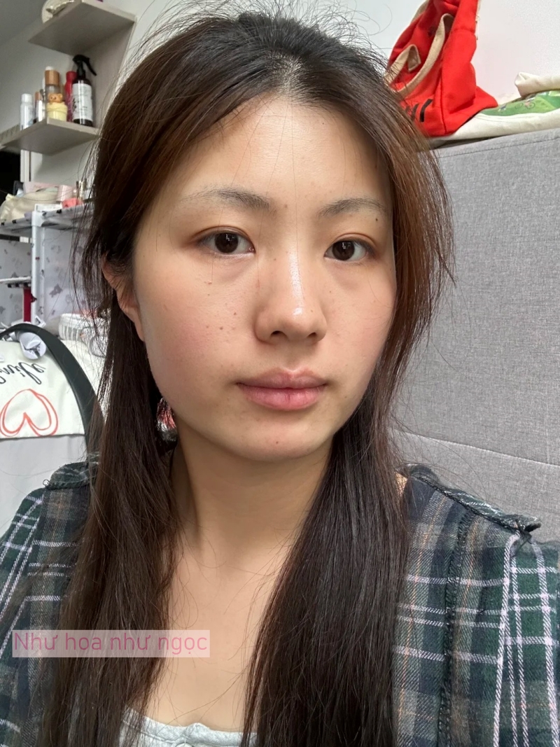 Tôi bất ngờ vì dùng serum collagen kèm cây lăn kim, ban đầu hơi sợ nhưng càng dùng lại thấy da càng đẹp- Ảnh 2.