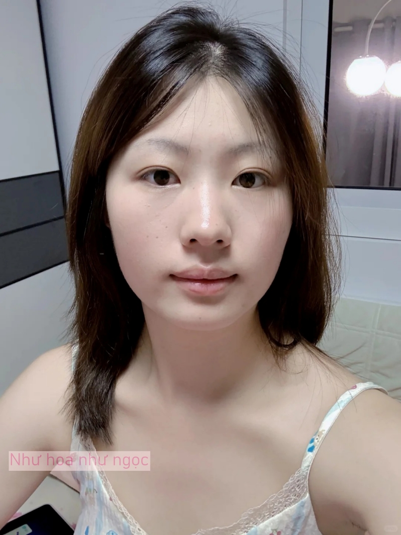 Tôi bất ngờ vì dùng serum collagen kèm cây lăn kim, ban đầu hơi sợ nhưng càng dùng lại thấy da càng đẹp- Ảnh 14.