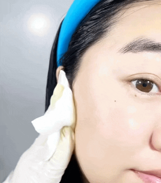 Tôi bất ngờ vì dùng serum collagen kèm cây lăn kim, ban đầu hơi sợ nhưng càng dùng lại thấy da càng đẹp- Ảnh 5.