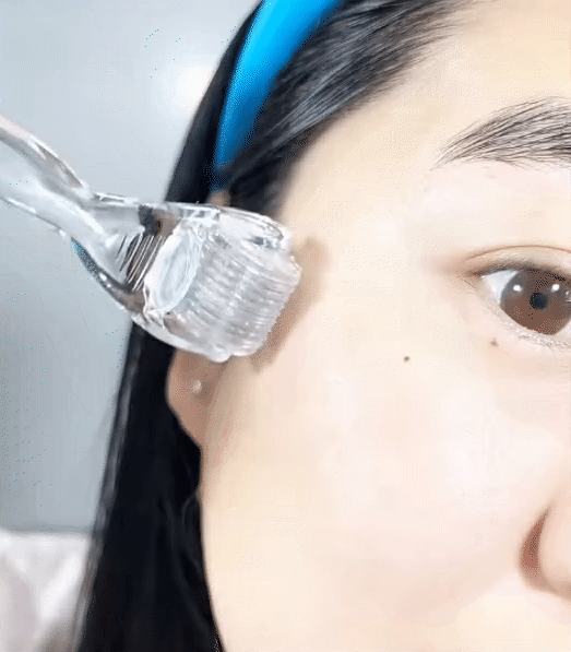 Tôi bất ngờ vì dùng serum collagen kèm cây lăn kim, ban đầu hơi sợ nhưng càng dùng lại thấy da càng đẹp- Ảnh 7.