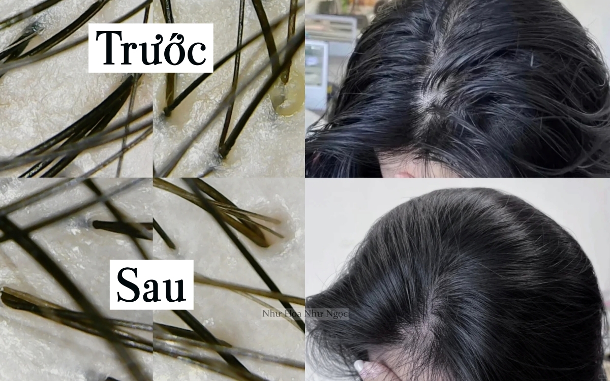 Dùng dầu tẩy trang để gội đầu, phần chân tóc của tôi bồng bềnh sạch thoáng ngoài mong đợi- Ảnh 4.