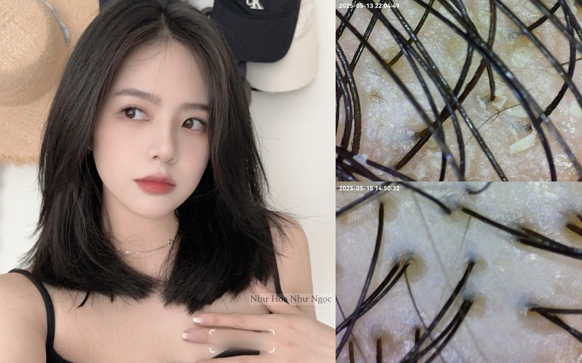 Dùng dầu tẩy trang để gội đầu, phần chân tóc của tôi bồng bềnh sạch thoáng ngoài mong đợi- Ảnh 2.