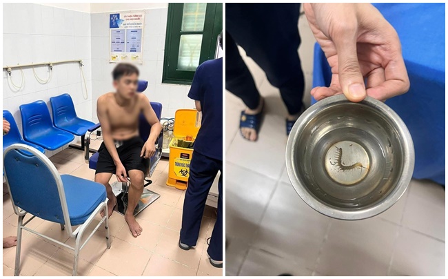 Rết chui vào tai khi đang chạy lũ ở Thái Nguyên: Nam sinh chảy máu, phát sốt vì đau buốt- Ảnh 1.