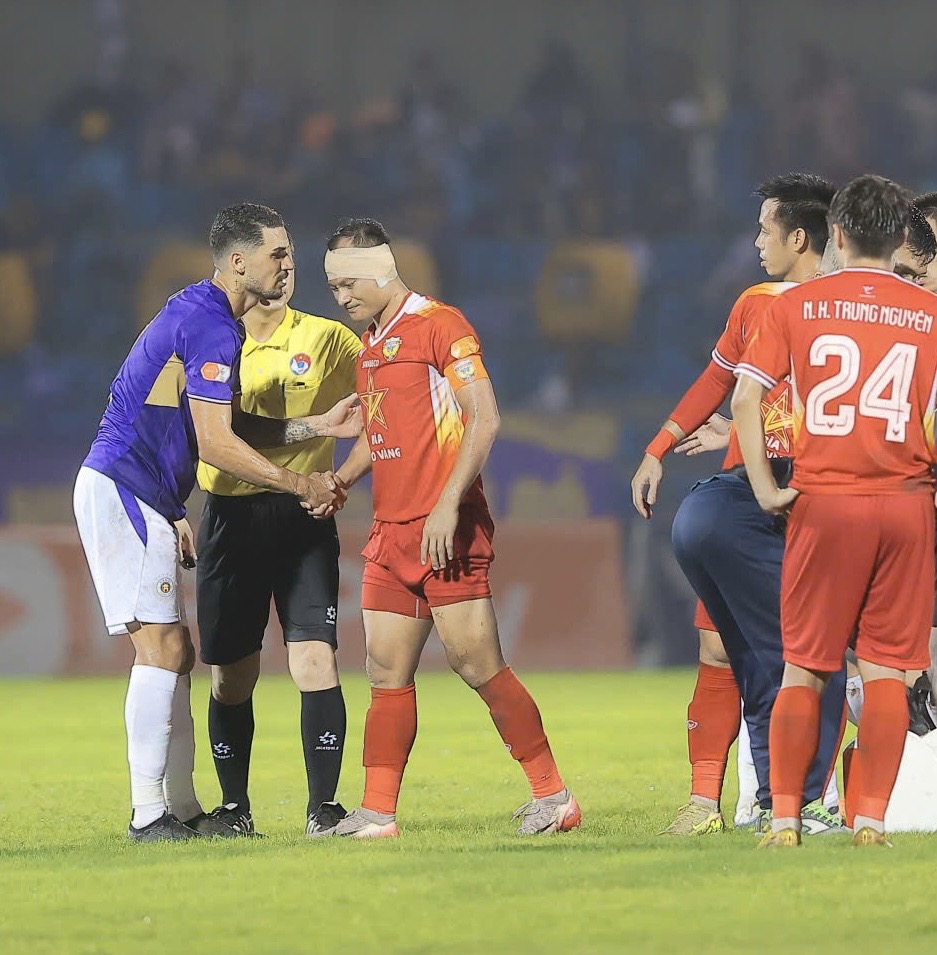 Trọng Hoàng bị Hoàng Hên giẫm rách tai ở V.League- Ảnh 2. Trọng Hoàng bị Hoàng Hên giẫm rách tai ở V.League- Ảnh 2.