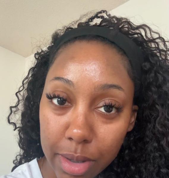 Quá sợ tuổi già, ngày càng nhiều cô gái U30 làm các loại phẫu thuật thẩm mỹ trước đây chỉ dành cho U60- Ảnh 11.