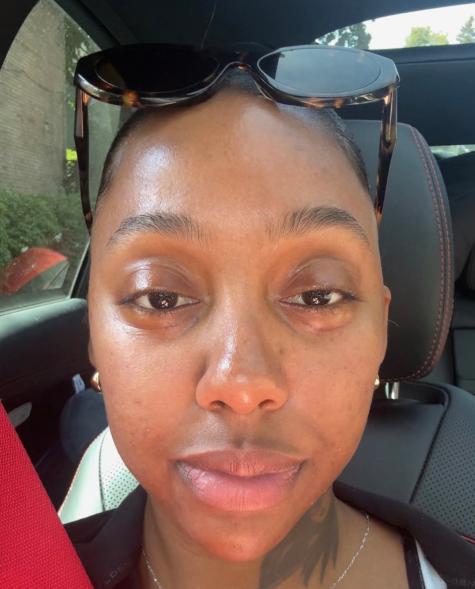 Quá sợ tuổi già, ngày càng nhiều cô gái U30 làm các loại phẫu thuật thẩm mỹ trước đây chỉ dành cho U60- Ảnh 12.