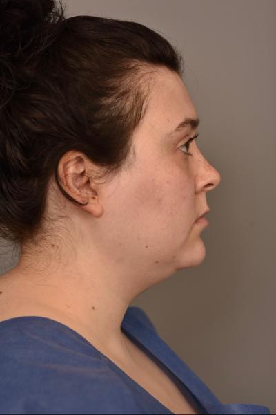 Quá sợ tuổi già, ngày càng nhiều cô gái U30 làm các loại phẫu thuật thẩm mỹ trước đây chỉ dành cho U60- Ảnh 9.