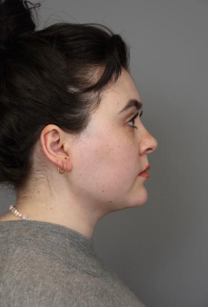 Quá sợ tuổi già, ngày càng nhiều cô gái U30 làm các loại phẫu thuật thẩm mỹ trước đây chỉ dành cho U60- Ảnh 10.