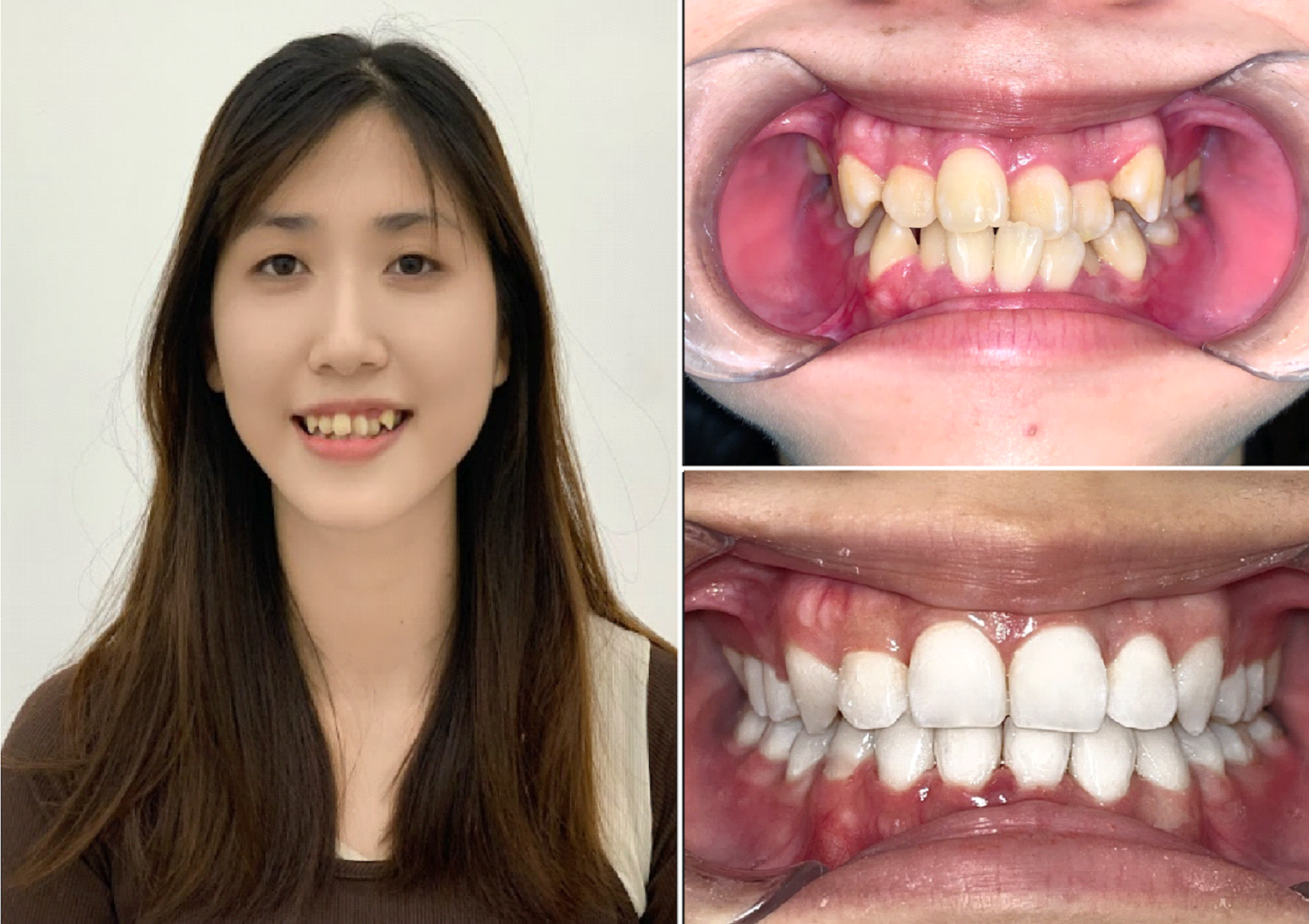 Phương pháp chữa bệnh nhiều người tưởng “chỉ để làm đẹp”- Ảnh 3. Phương pháp chữa bệnh nhiều người tưởng “chỉ để làm đẹp”- Ảnh 3.