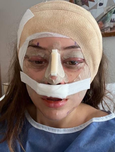 Quá sợ tuổi già, ngày càng nhiều cô gái U30 làm các loại phẫu thuật thẩm mỹ trước đây chỉ dành cho U60- Ảnh 3.