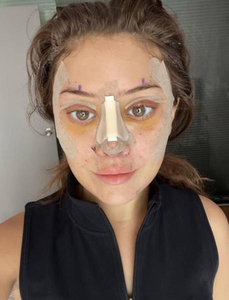 Quá sợ tuổi già, ngày càng nhiều cô gái U30 làm các loại phẫu thuật thẩm mỹ trước đây chỉ dành cho U60- Ảnh 4.