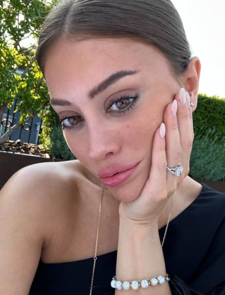 Quá sợ tuổi già, ngày càng nhiều cô gái U30 làm các loại phẫu thuật thẩm mỹ trước đây chỉ dành cho U60- Ảnh 1.