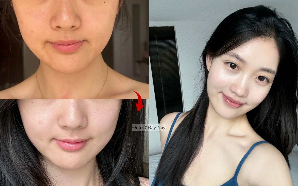 BTV chọn ra 5 sản phẩm làm trắng da, ngừa nám toàn diện ai dùng cũng mê- Ảnh 1.