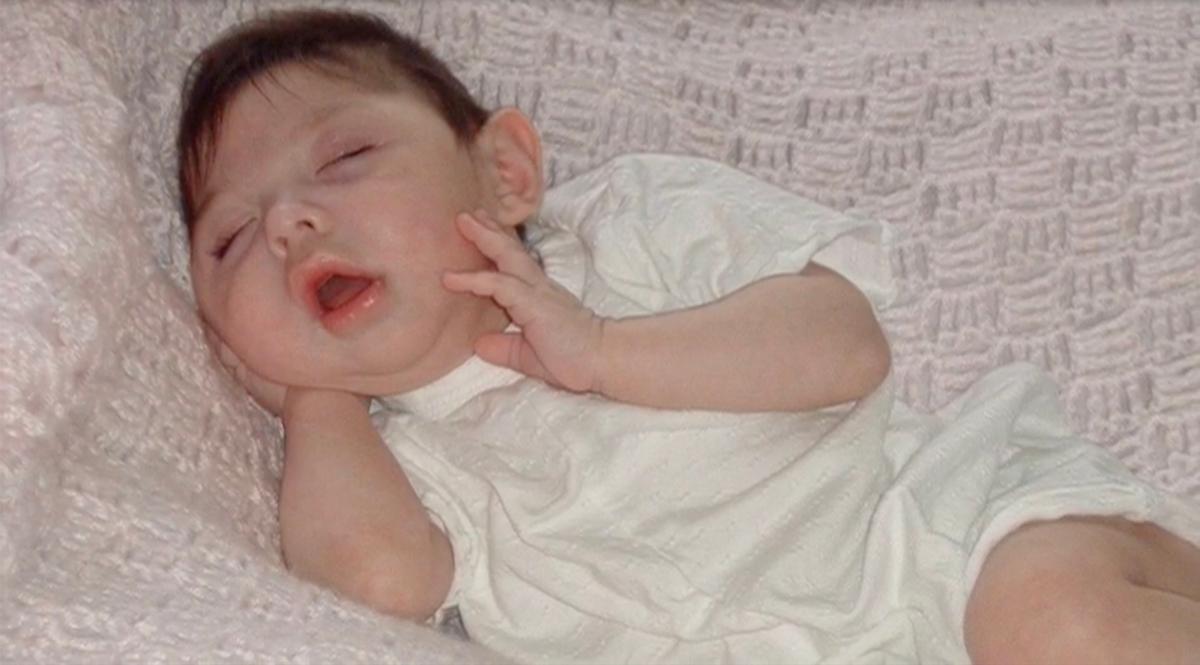 Cô bé sinh ra không có não bây giờ ra sao?- Ảnh 1.