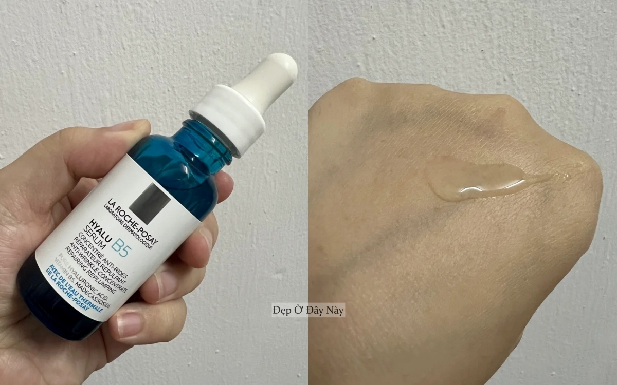 Ở tuổi 27, tôi đã tìm được "chân ái" trị da mụn, lỗ chân lông to- Ảnh 4.