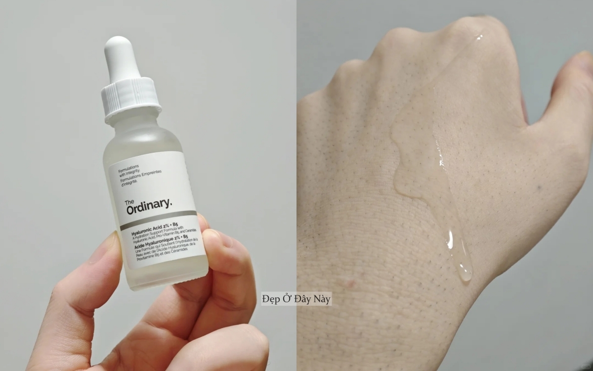 Ở tuổi 27, tôi đã tìm được "chân ái" trị da mụn, lỗ chân lông to- Ảnh 3.