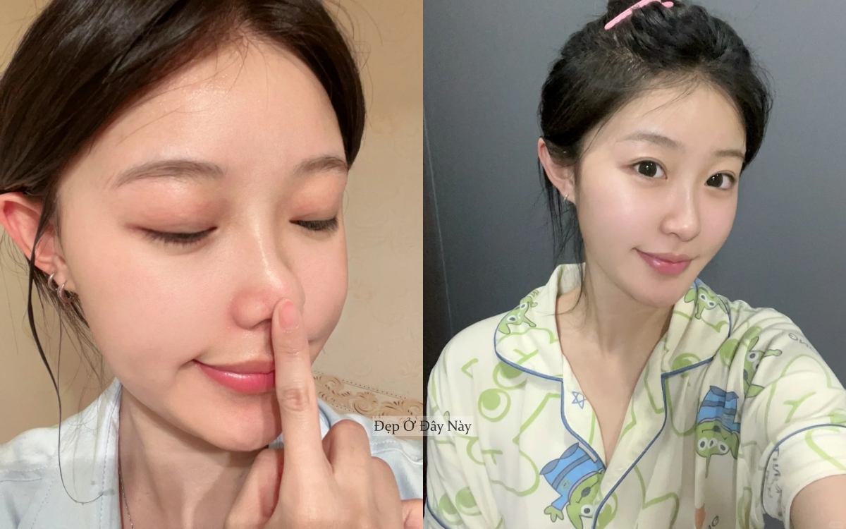 Ở tuổi 27, tôi đã tìm được "chân ái" trị da mụn, lỗ chân lông to- Ảnh 1.