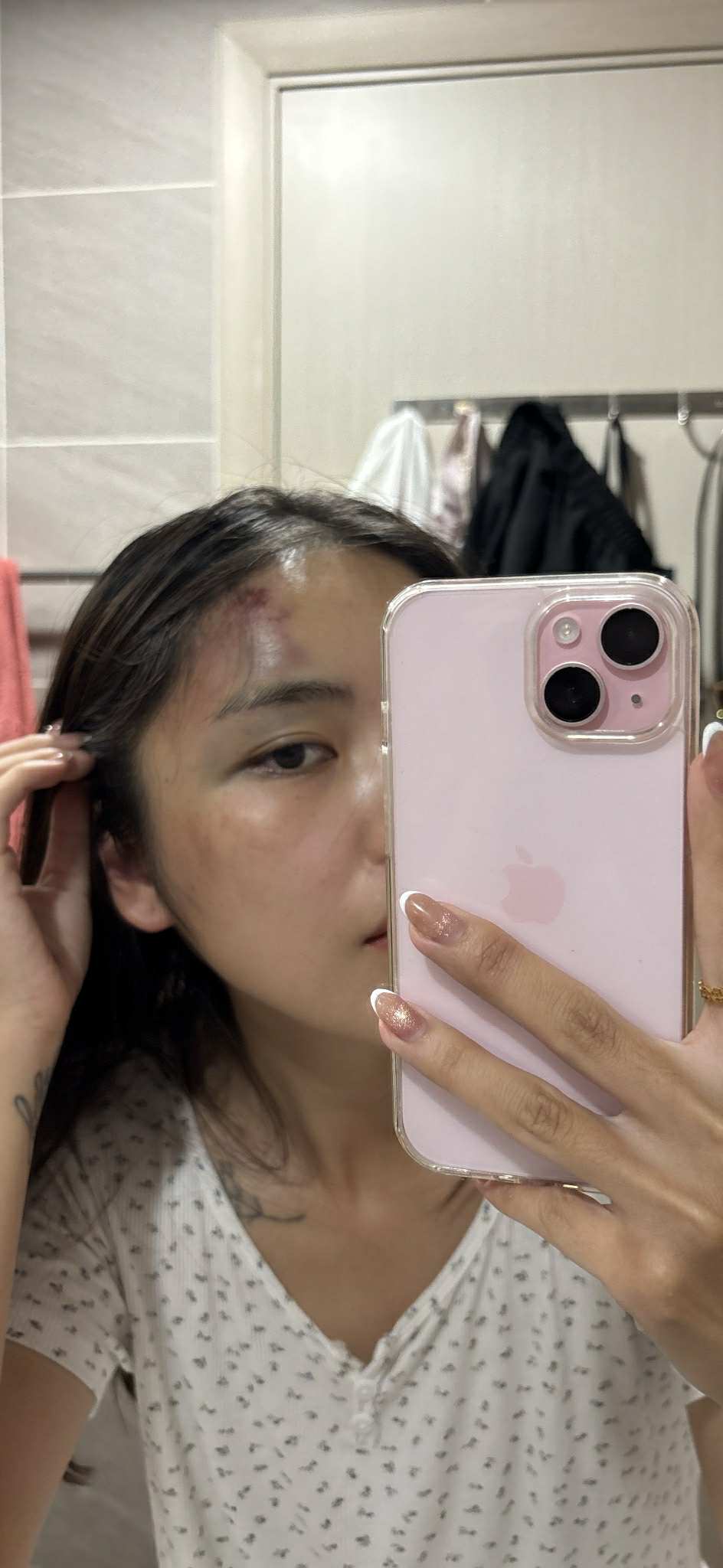 Kinh hãi cảnh chồng lôi vợ ra đánh giữa hành lang chung cư, thủng màng nhĩ, chấn động não ngay trước mắt hàng xóm- Ảnh 3.