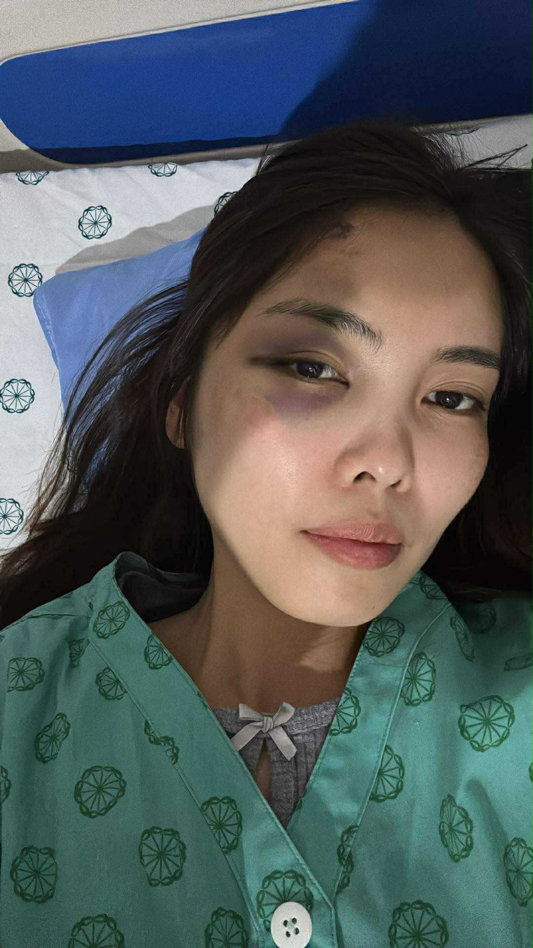 Kinh hãi cảnh chồng lôi vợ ra đánh giữa hành lang chung cư, thủng màng nhĩ, chấn động não ngay trước mắt hàng xóm- Ảnh 1.