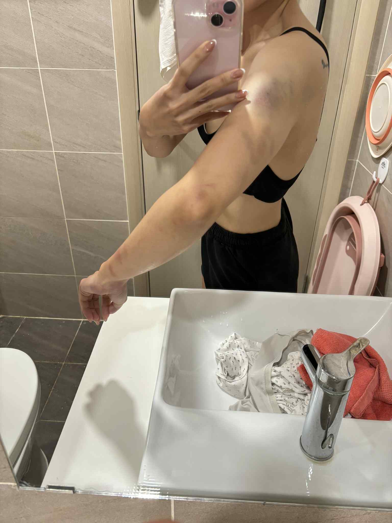 Kinh hãi cảnh chồng lôi vợ ra đánh giữa hành lang chung cư, thủng màng nhĩ, chấn động não ngay trước mắt hàng xóm- Ảnh 4.