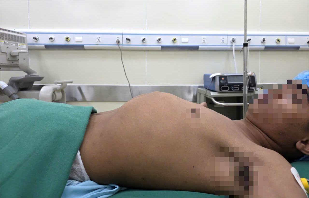 Thanh niên bị "bệnh lạ", tỉ lệ 1/1.000 người mắc- Ảnh 1.