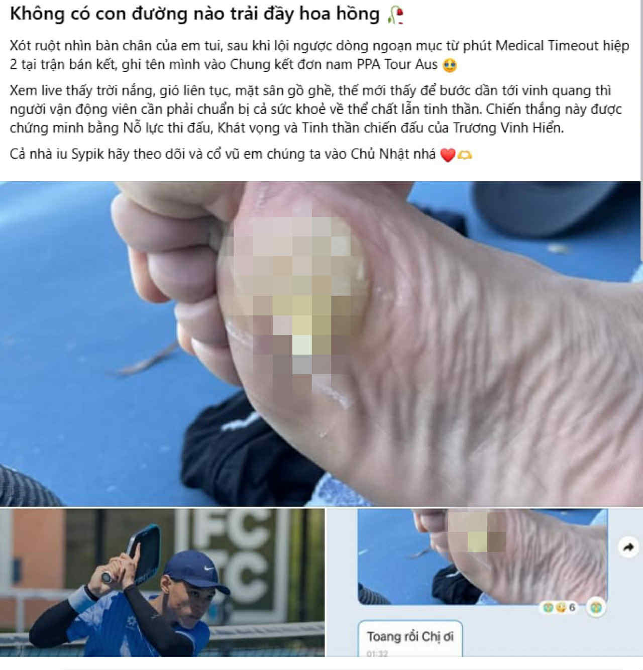 Xót xa bàn chân phồng rộp của Trương Vinh Hiển- Ảnh 1. Xót xa bàn chân phồng rộp của Trương Vinh Hiển- Ảnh 1.