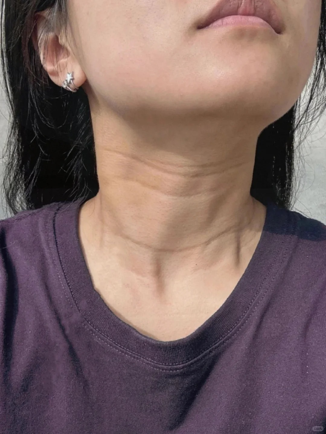 5 vùng da lão hóa nhanh nhất mà 90% chị em đều bỏ quên, nhìn vào dễ tưởng là người già- Ảnh 4.