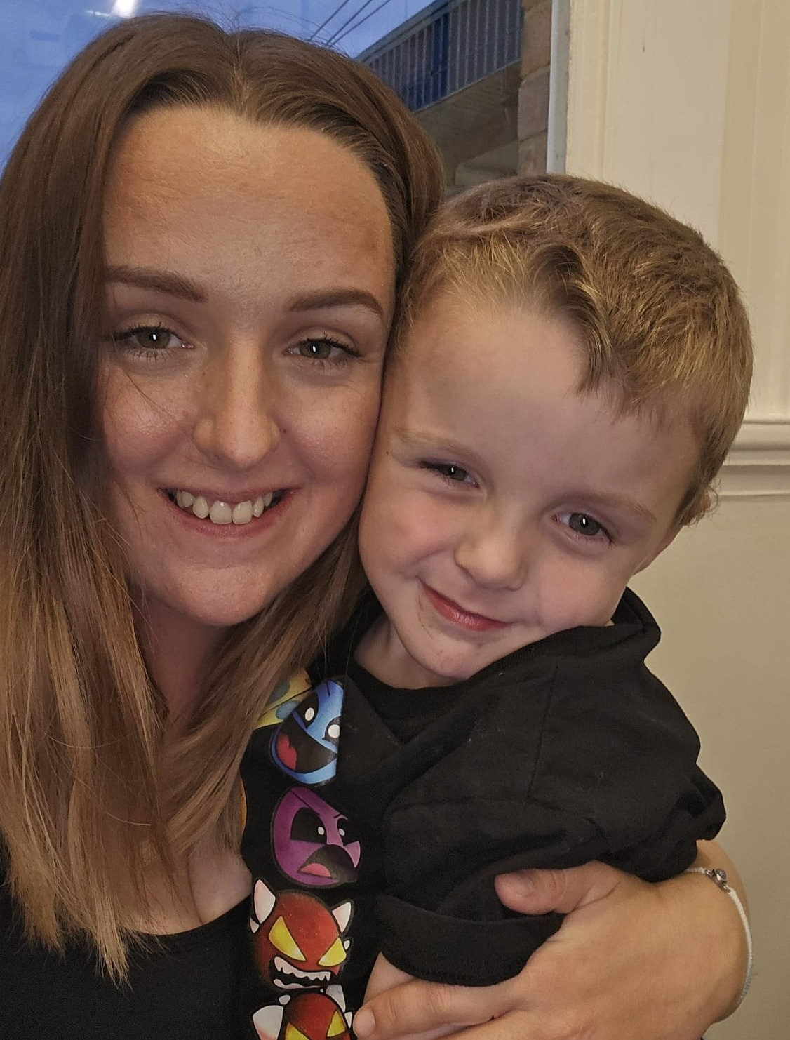 Bé trai 5 tuổi bị chó dữ tấn công khi đang đi dạo ở công viên- Ảnh 1.