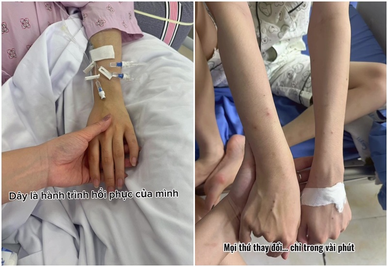 Cuộc sống sau đột quỵ của nữ nhân viên văn phòng 28 tuổi ở Thái Nguyên- Ảnh 2. Cuộc sống sau đột quỵ của nữ nhân viên văn phòng 28 tuổi ở Thái Nguyên- Ảnh 2.