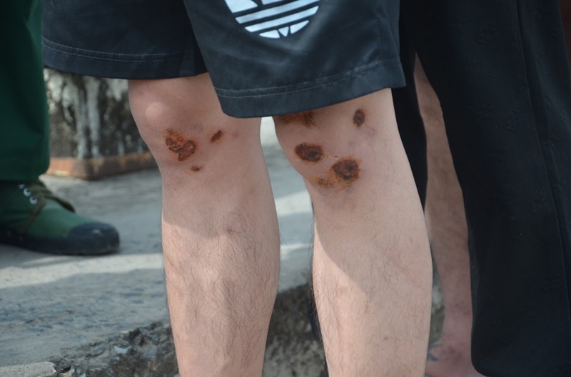 Nam thanh niên rùng mình kể lại phút kinh hoàng khi làm việc ở Campuchia: Bị giam lỏng, chích điện bỏ đói, đòi 5.000 USD chuộc- Ảnh 2.