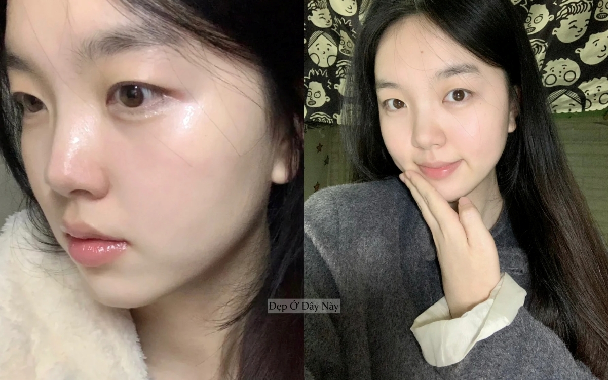 Cô nàng da khô tìm ra 3 serum cấp nước “thần thánh”, giúp da ngậm nước căng mẩy như da em bé- Ảnh 5.