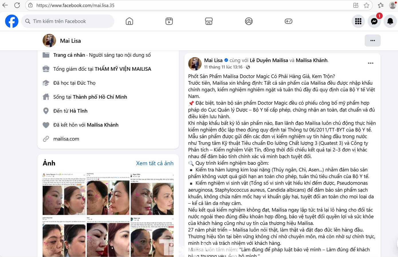 “Bà trùm” thẩm mỹ Mailisa vừa dính lùm xùm bán kem trộn thế nào?- Ảnh 1.