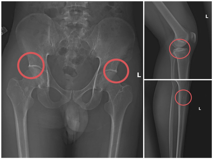 Cựu nhân viên y tế đục vỡ xương trục lợi bảo hiểm: Thủ đoạn tàn nhẫn, bất nhân- Ảnh 2.
