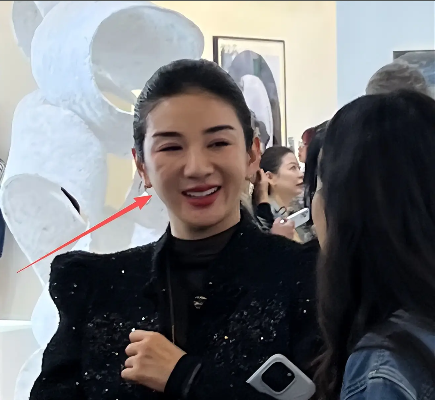 Gương mặt Tiểu Yến Tử bị làm sao vậy?- Ảnh 1. Gương mặt Tiểu Yến Tử bị làm sao vậy?- Ảnh 1.