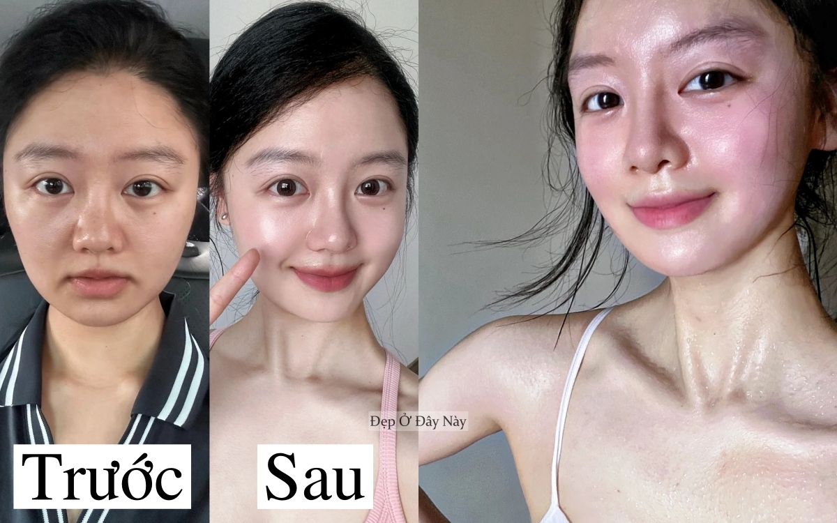 Trẻ hơn 5 tuổi nhờ 5 mẹo cải thiện rãnh cười đơn giản tại nhà- Ảnh 2.