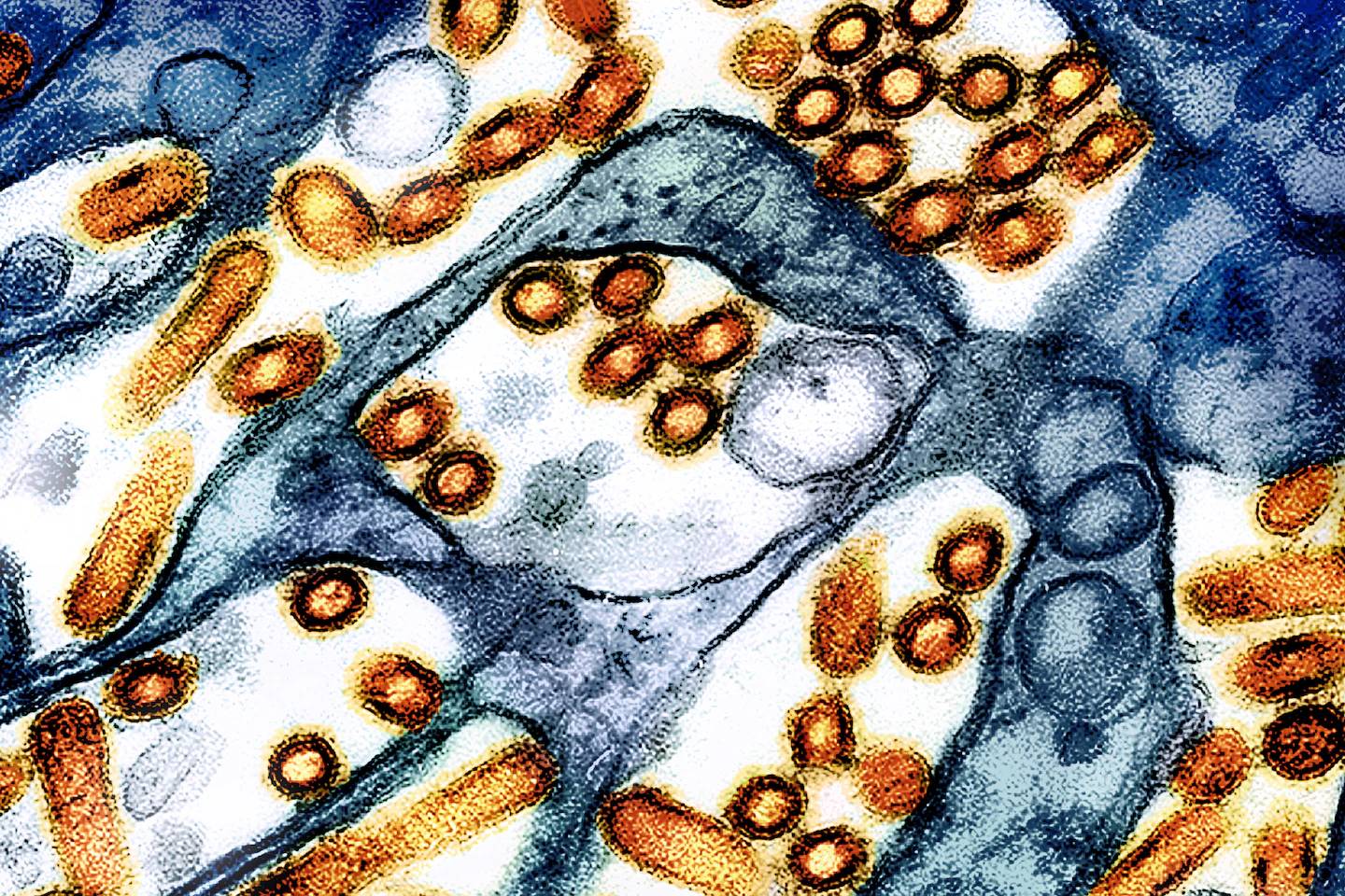 Phát hiện chủng virus cúm gia cầm chưa từng thấy ở người tại Mỹ- Ảnh 1. Phát hiện chủng virus cúm gia cầm chưa từng thấy ở người tại Mỹ- Ảnh 1.