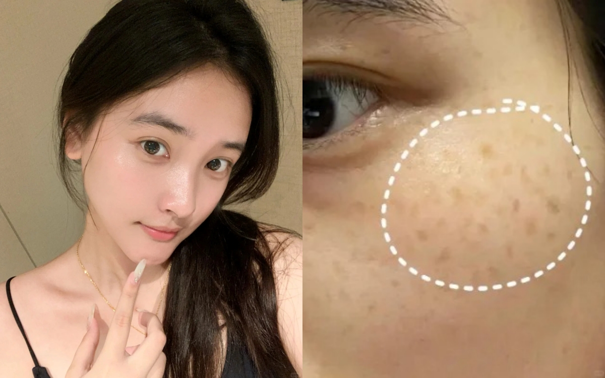 Không cần mỹ phẩm ngoại, đây là 5 kem dưỡng "made in Vietnam" làm mờ thâm, sáng da cực đỉnh- Ảnh 1.