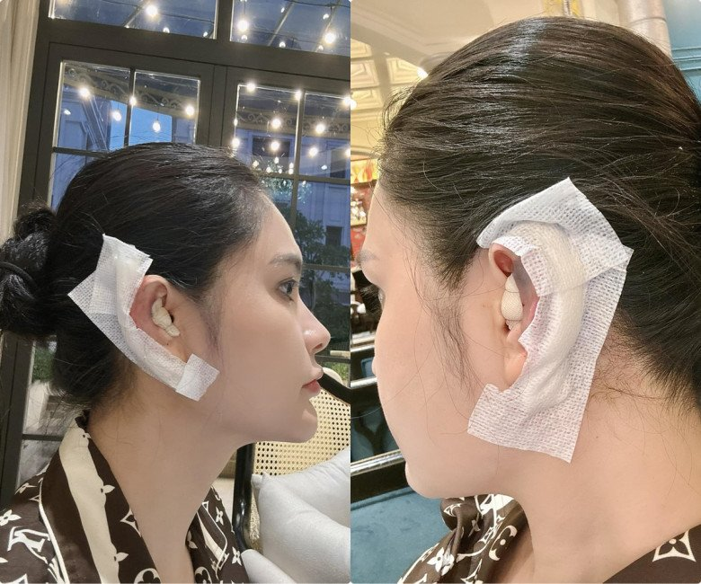 Cô gái khổ sở 30 năm vì tai giống Đoàn Di Băng- Ảnh 9. Cô gái khổ sở 30 năm vì tai giống Đoàn Di Băng- Ảnh 9.