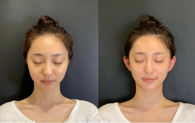 Cô gái khổ sở 30 năm vì tai giống Đoàn Di Băng- Ảnh 5. Cô gái khổ sở 30 năm vì tai giống Đoàn Di Băng- Ảnh 5.