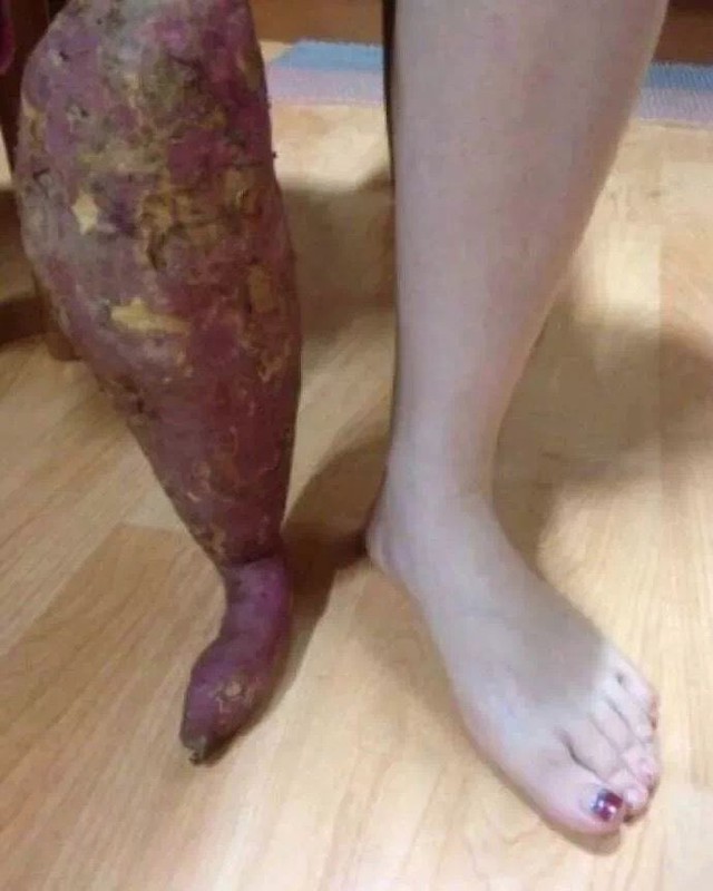 Bức ảnh làm 50 triệu người bật cười, nhưng lại khiến mẹ tôi khóc nức nở- Ảnh 1.