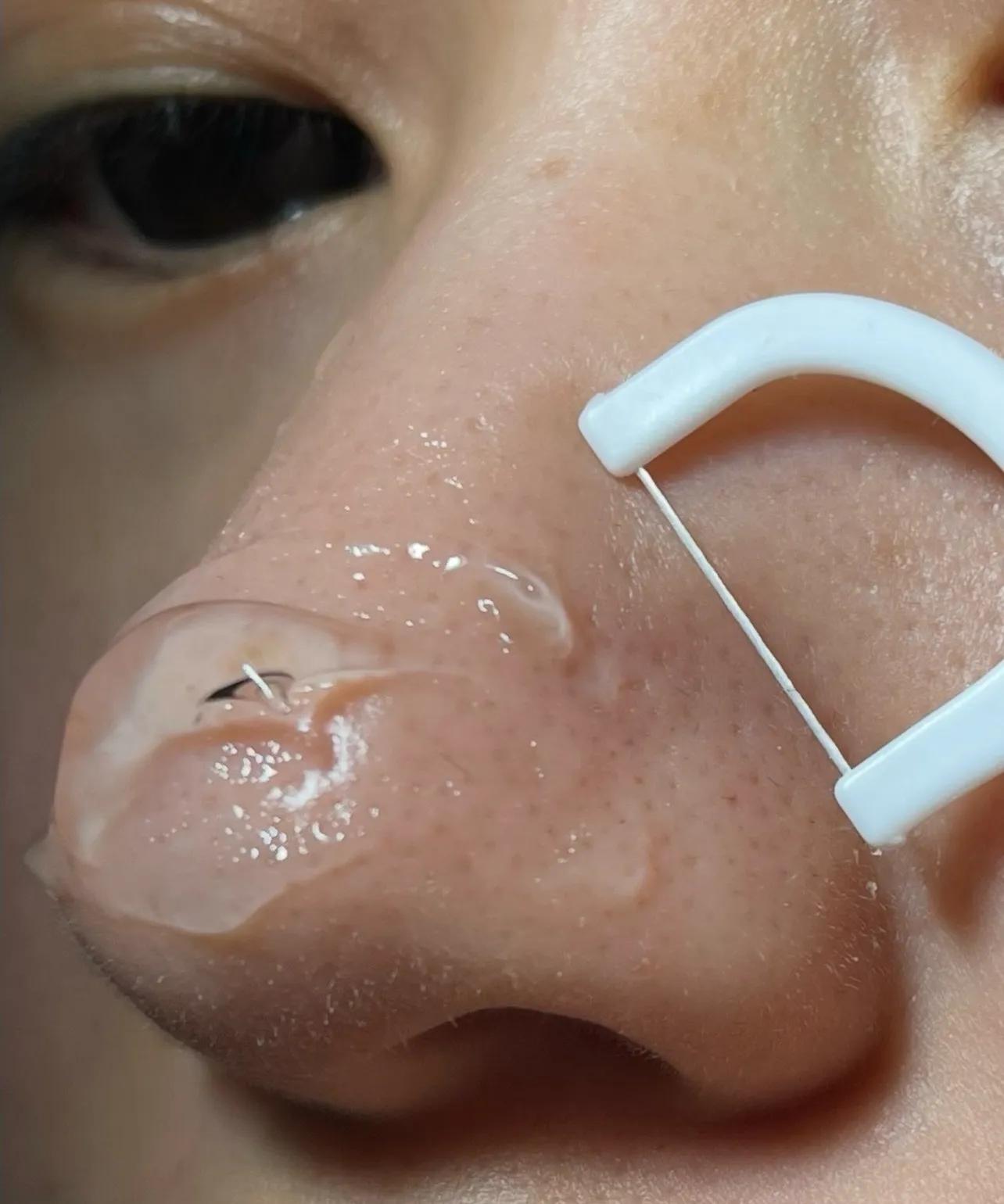 Món đồ bác sĩ khuyên dùng: Công dụng 