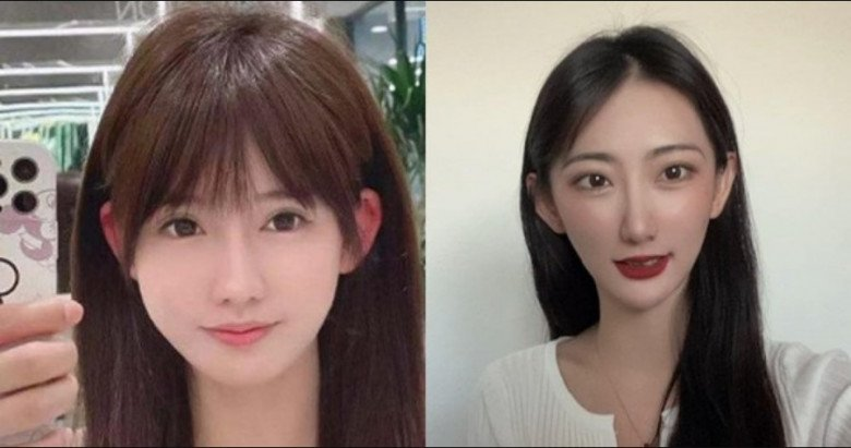 Cô gái khổ sở 30 năm vì tai giống Đoàn Di Băng- Ảnh 4. Cô gái khổ sở 30 năm vì tai giống Đoàn Di Băng- Ảnh 4.