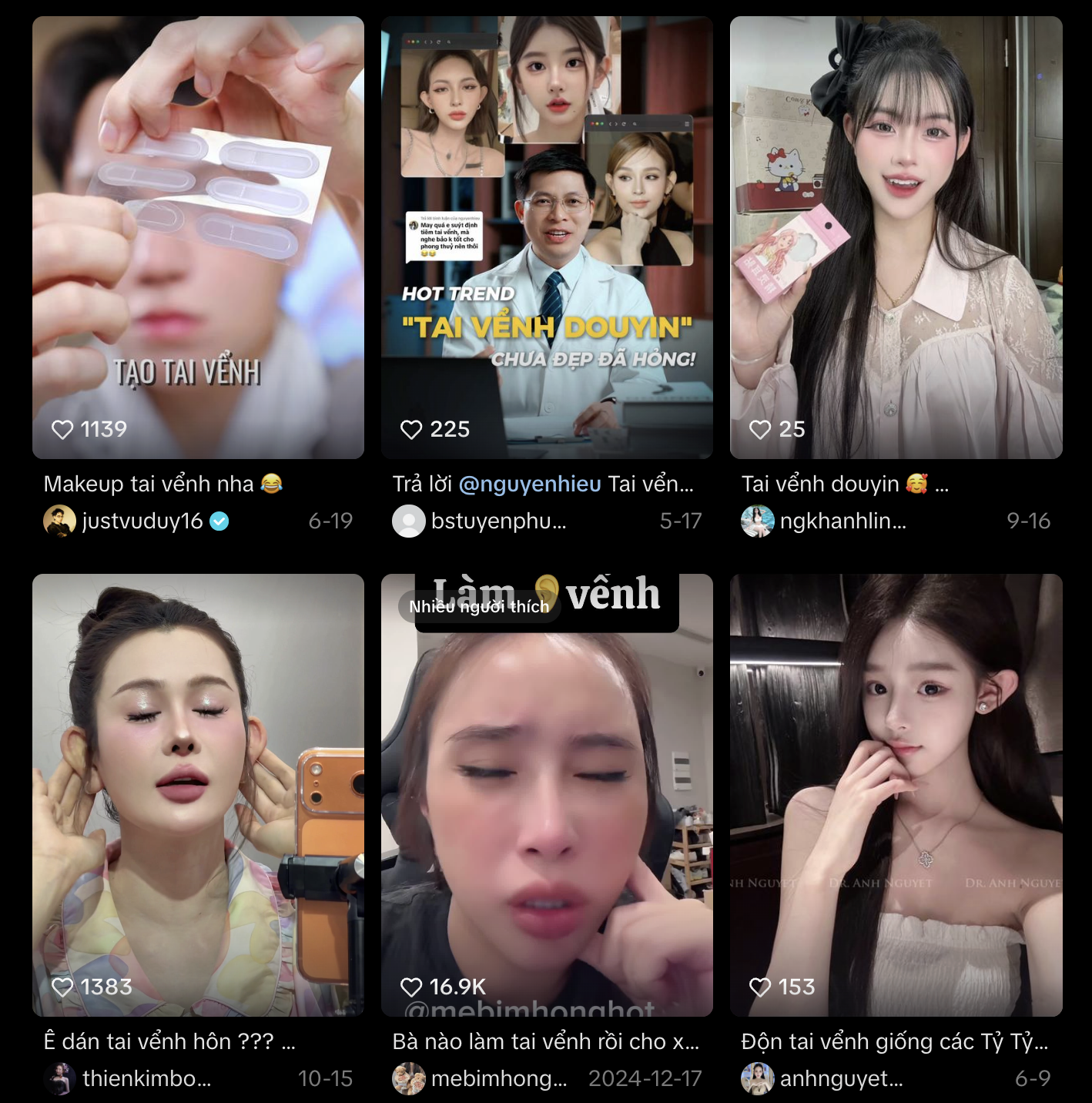 Cô gái khổ sở 30 năm vì tai giống Đoàn Di Băng- Ảnh 6. Cô gái khổ sở 30 năm vì tai giống Đoàn Di Băng- Ảnh 6.