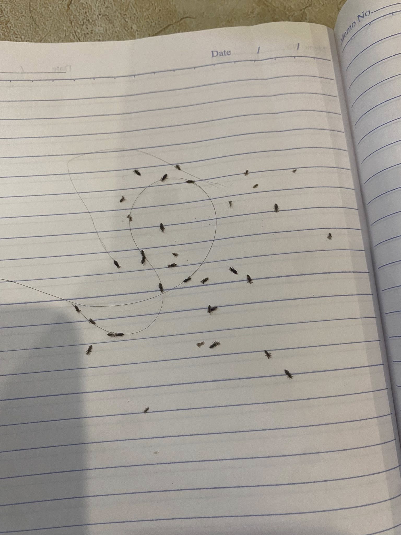 Sốc: 60 con chấy bò ra từ mái tóc của 