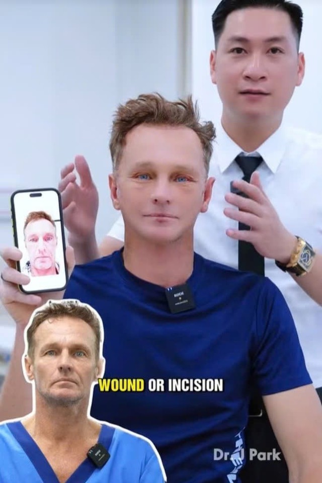 Người đàn ông Úc không chụp ảnh suốt 20 năm bỗng nổi tiếng sau khi đến Việt Nam phẫu thuật thẩm mỹ, điện thoại iPhone cũng không nhận diện được- Ảnh 3.