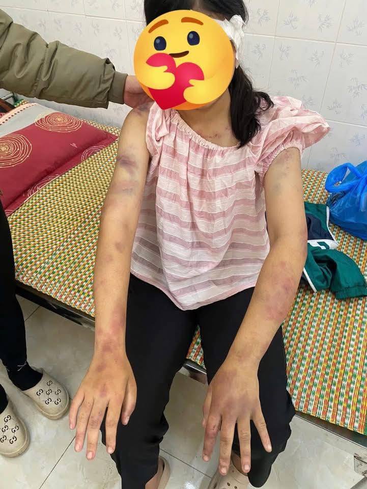 Hoàn cảnh cháu bé bị bà nội và 2 người đàn ông bạo hành: Bố mẹ ly hôn khi mới 1 tuổi, kể bị đánh 4 tiếng- Ảnh 2.